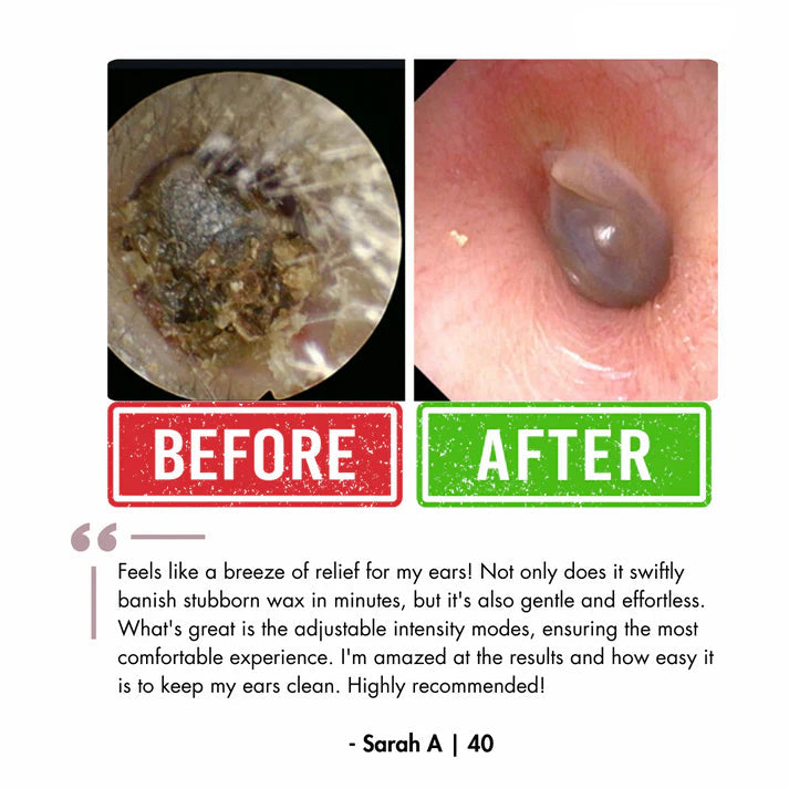 Orzyum™ Electric Earwax cleaner