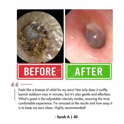 Orzyum™ Electric Earwax cleaner