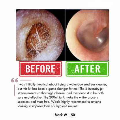 Orzyum™ Electric Earwax cleaner