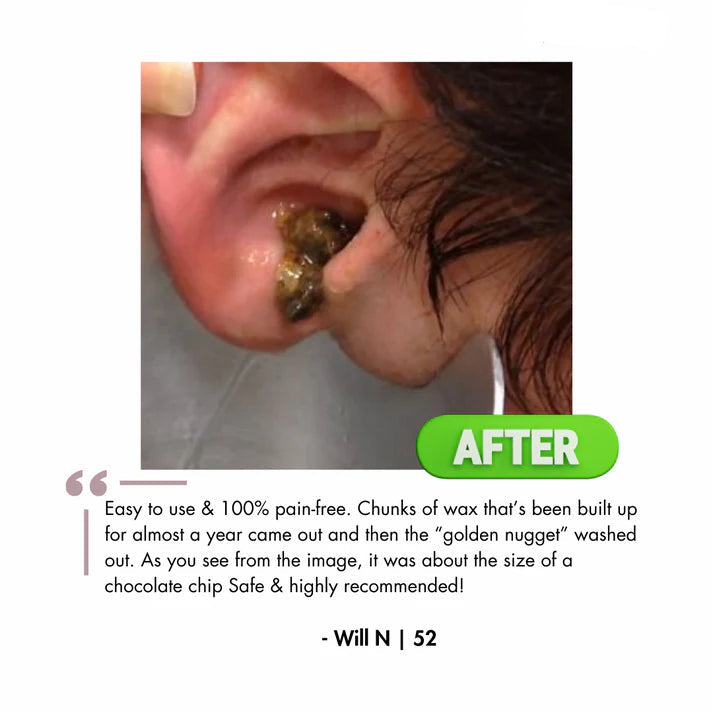 Orzyum™ Electric Earwax cleaner