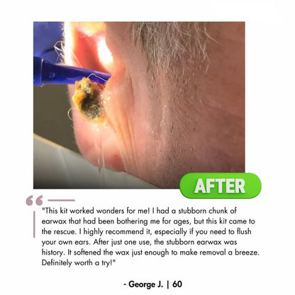 Orzyum™ Electric Earwax cleaner